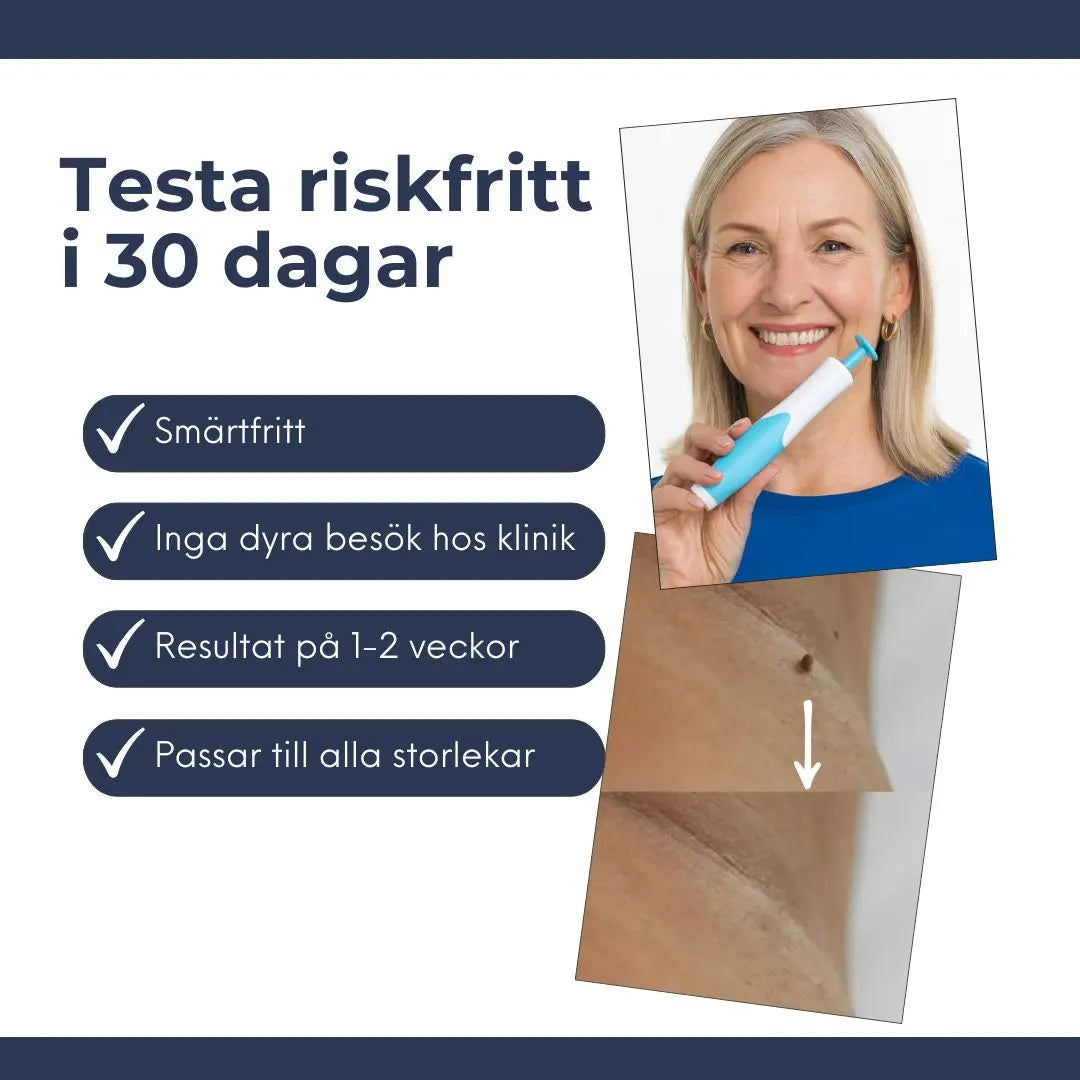 Hudfliksborttagare – Ta bort hudflikar snabbt, enkelt och smärtfritt hemma