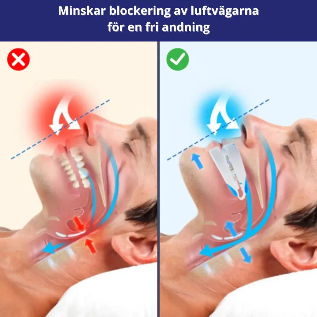Snarkskena mot Snarkning – FDA-Godkänd Lösning för Fria Luftvägar & Ostörda Nätter