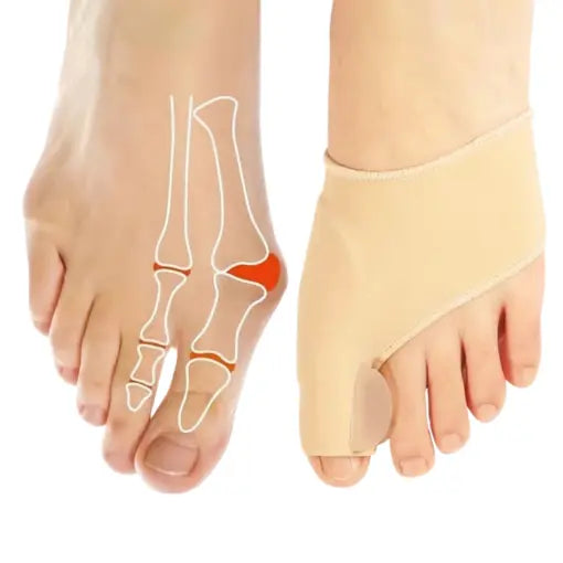 Tåseparatorer mot Hallux Valgus – Lindra Smärta & Rätta till Tåpositionen