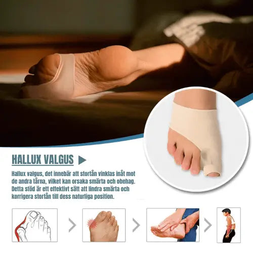 Tåseparatorer mot Hallux Valgus – Lindra Smärta & Rätta till Tåpositionen