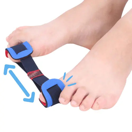 Tåseparerare för Hallux Valgus – Stretcha & Räta Stortån Skonsamt Varje Dag